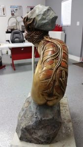 Muchacha Condenada a Vivir con una Piedra en la Cabeza